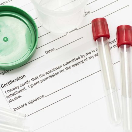 Should you Keep Drug Testing during the Pandemic
